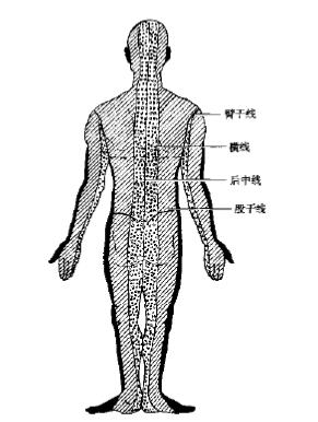 中医针刺绝招大全,针灸腕踝针位置示意图