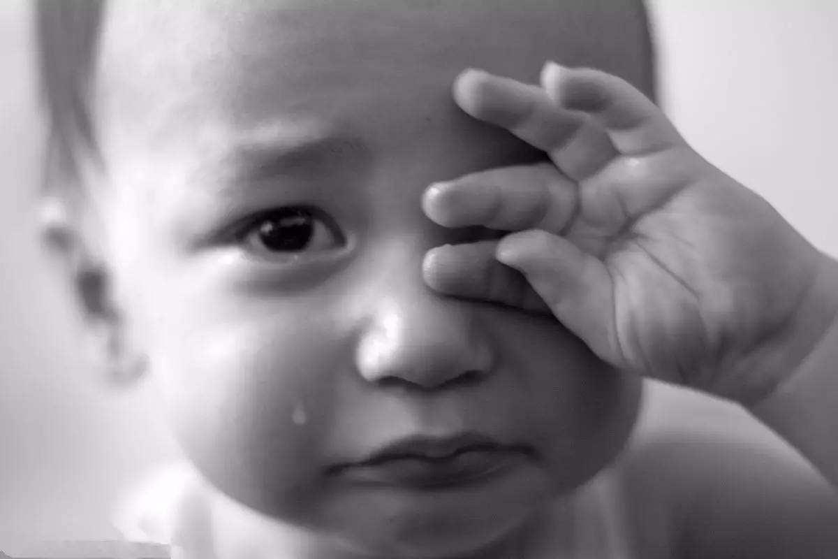 宝宝眼睛红肿疑似红眼病怎么处理,宝宝经常会揉眼睛会得红眼病吗