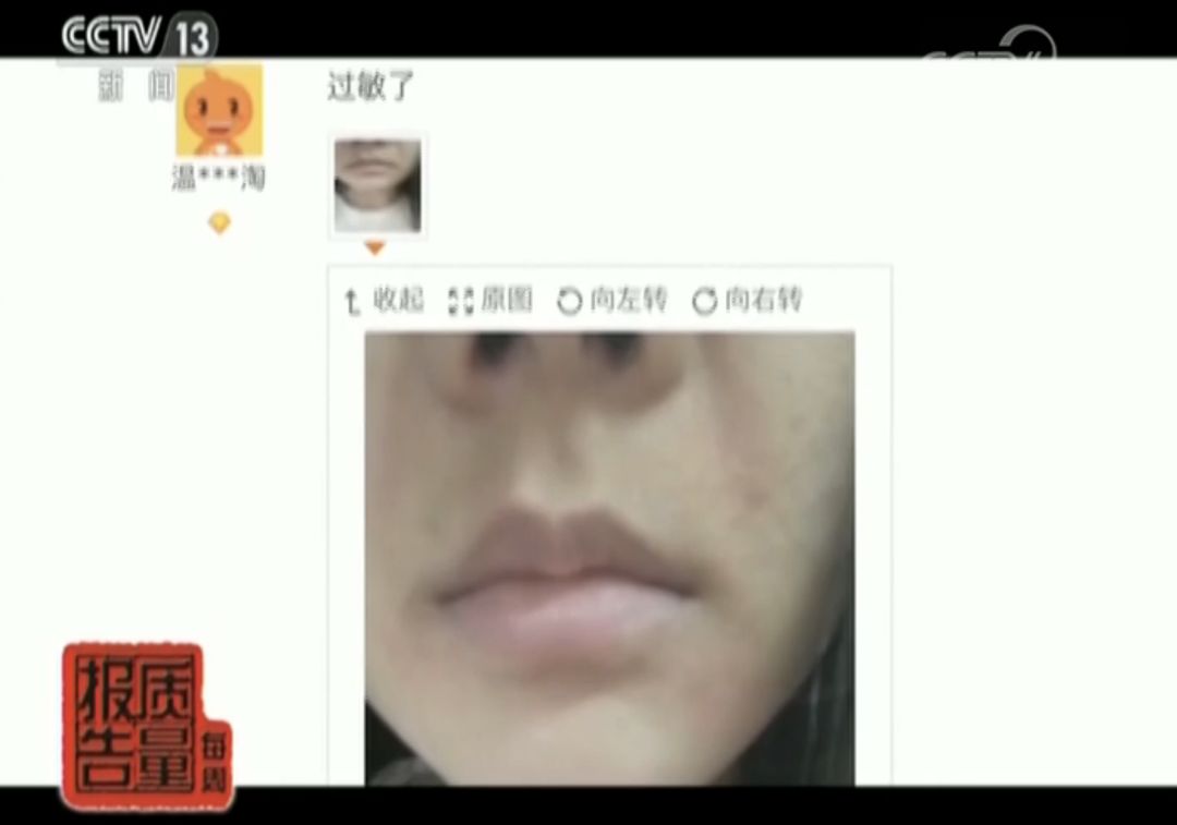 被推爆的网红面膜到底值不值得买,曝光会烂脸的面膜