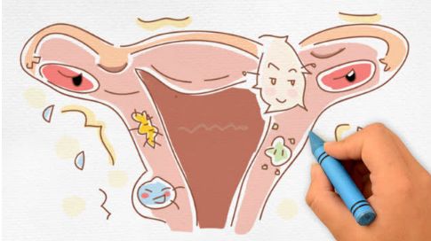 女性身体容易出现哪些疾病,身体出现这几种现象女人要绝经了