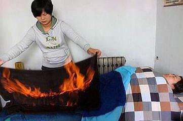 火疗爱好者，必须注意的问题