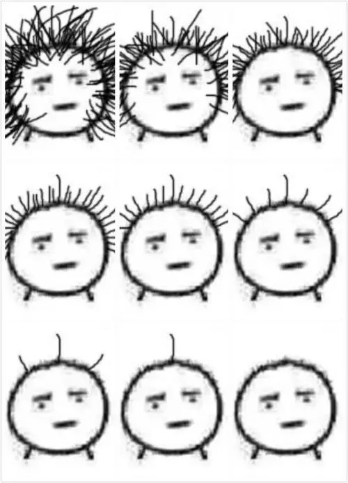 去腐国读书，脑壳秃了怎么补救？