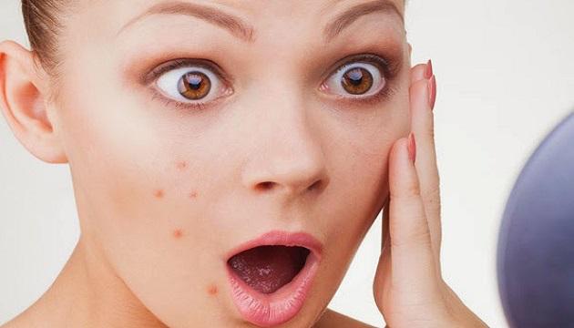 青春痘光动力疗法,青春痘光动力治疗多少钱