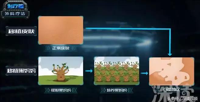 激光治疗和皮肤移植哪家强？治疗白癜风，最新黑科技大盘点