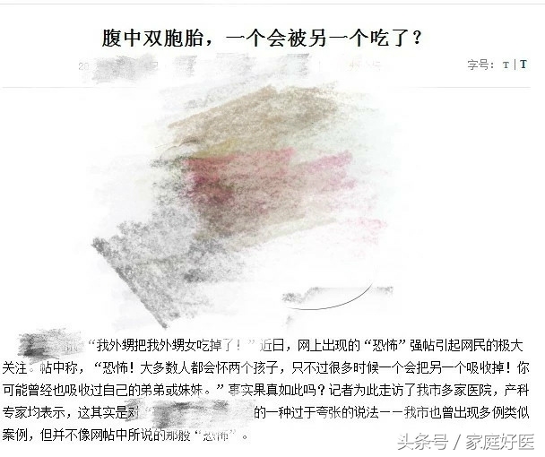 怀双胞胎一个会被另一个吸收吗,双胞胎吃掉另一个胎儿