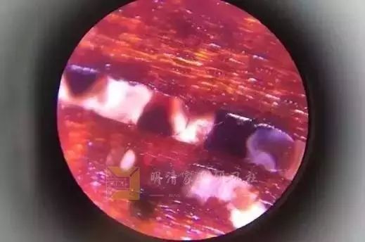 金星和牛毛纹图片,牛毛纹和棕眼图解