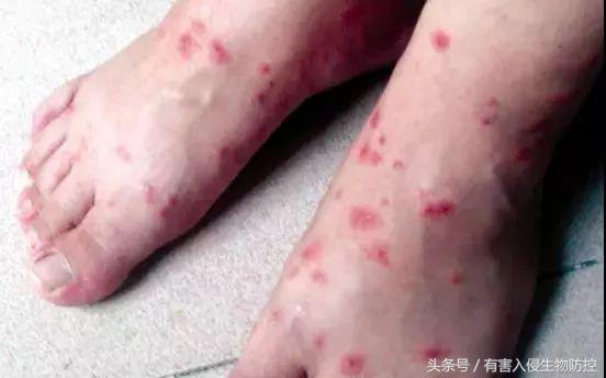 生物入侵红火蚁视频,红火蚁为什么是入侵物