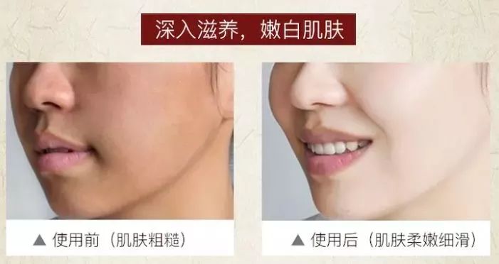 脸上污垢,脸上的脏东西真能清理出来吗