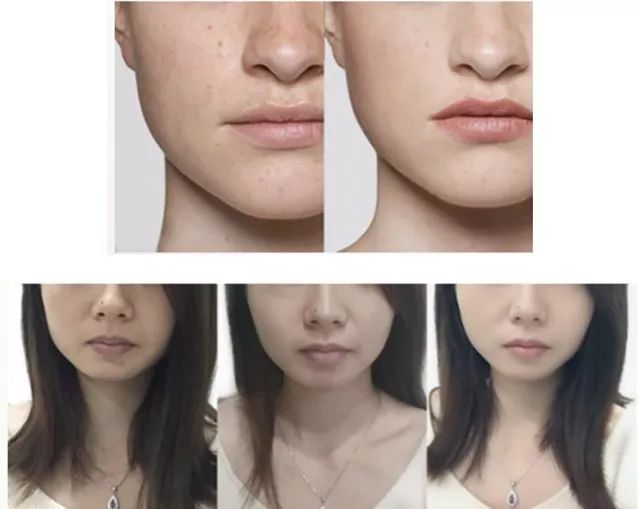 澳洲美白丸最佳吃法,澳洲玫瑰果美白丸