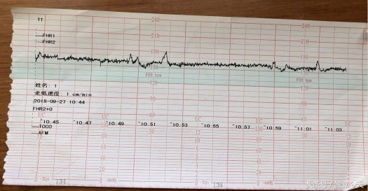 34周胎心监测胎动期间胎心率不高,33周胎心监测显示有宫缩