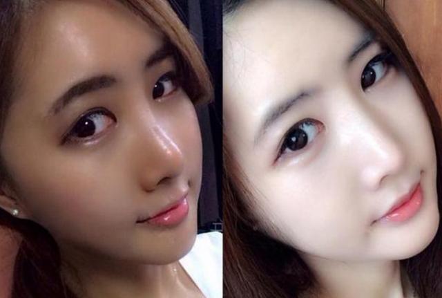 每天晚上涂一次皮肤年轻得太快了,睡觉前涂的精华一个月皮肤变好