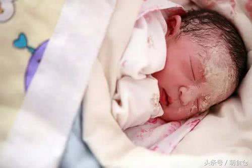 新生儿生殖系统正常生理现象,新生儿有哪些特殊生理现象