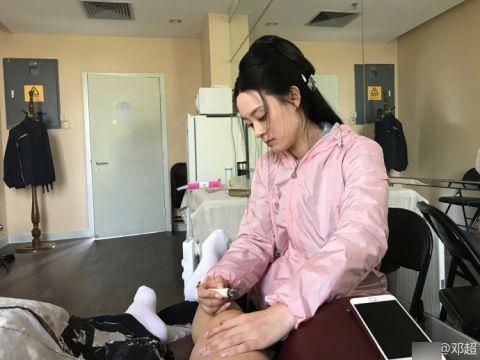 孙俪中医调理,孙俪艾灸熏眼