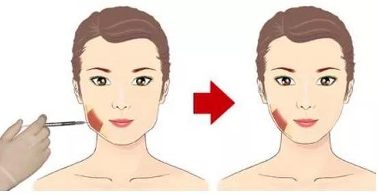 韩国粉肉瘦脸针安全吗,选择美容院打瘦脸针安全吗