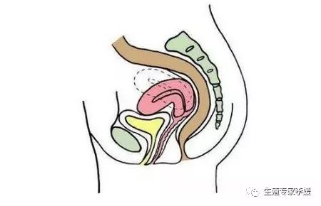 子宫的位置影响试管吗,怀孕四个月子宫位置