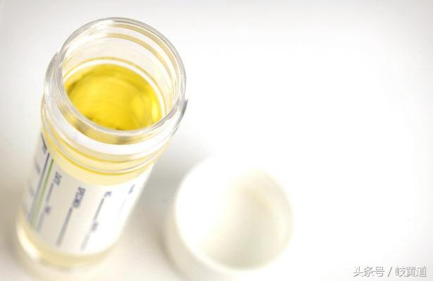 原以为是尿路感染，竟出现尿血、发热，怎么回事？