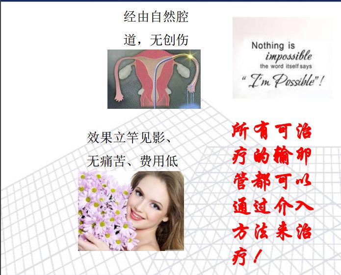 输卵管臭氧介入治疗和造影剂,介入治疗输卵管堵塞需要打麻药嘛