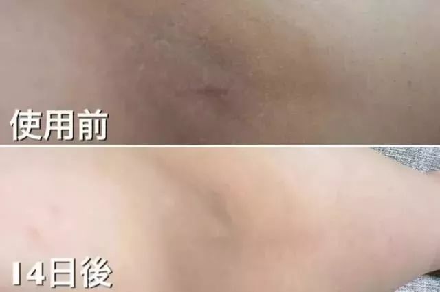 洗屁屁变白的香皂,洗屁屁香皂真的会变白吗