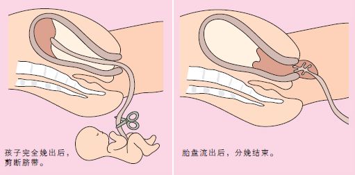 动画分娩过程科普,孕妈分娩的整个过程