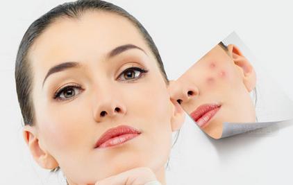 网红祛痘膏危害,网红祛疤膏打假