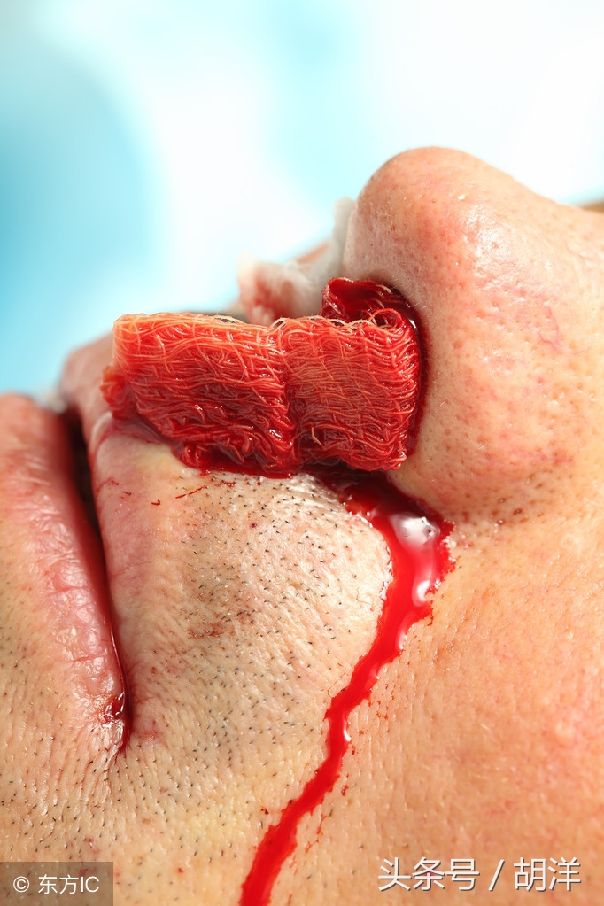 靶向药治疗肿瘤效果好，但副作用到底有多大？医生终于说了实话！