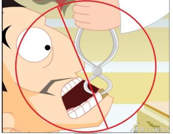 根管后戴个牙冠，是牙医在忽悠你吗？