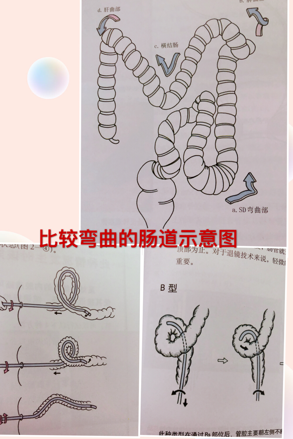 做肠镜需要注意事项,做肠镜的注意事项有哪些