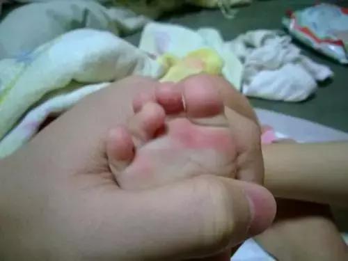 童鞋很臭怎么办,童鞋臭脚是哪的原因