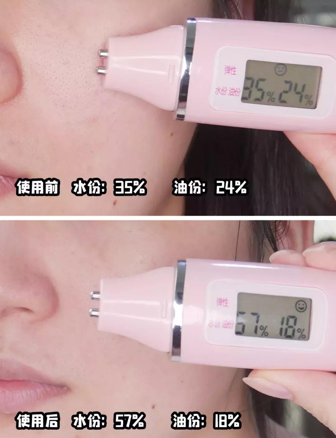 面膜口碑排行榜前十,面膜销量排行榜医用