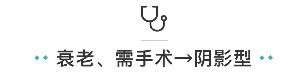 黑眼圈怎么去除最快方法,黑眼圈怎么去除最有效的方法