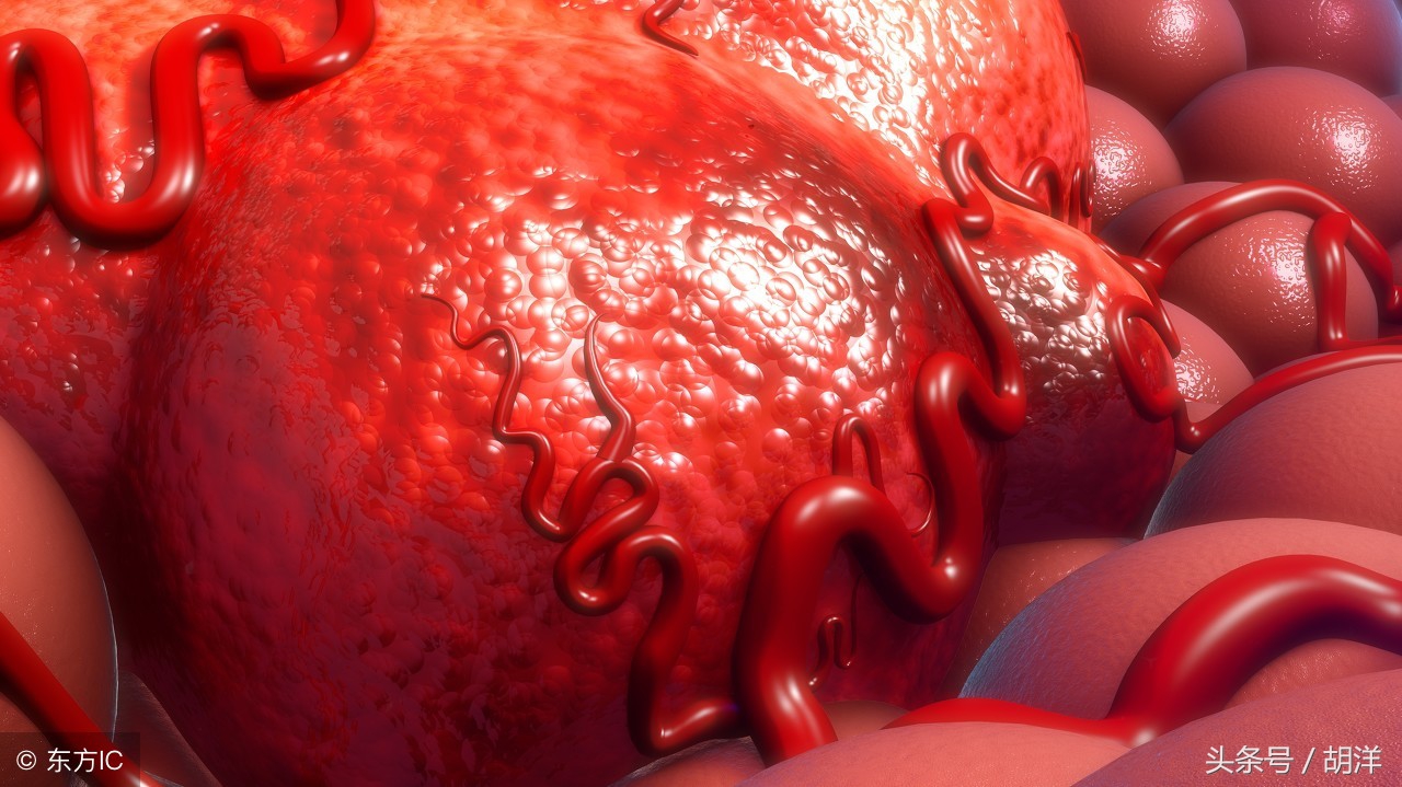 肿瘤标志物铁蛋白什么意思,肿瘤标志物中铁蛋白高说明什么