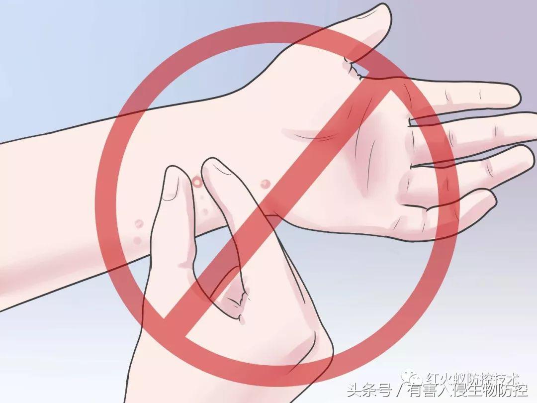 被红火蚁咬的治疗方法,被红火蚁咬后怎么处理偏方