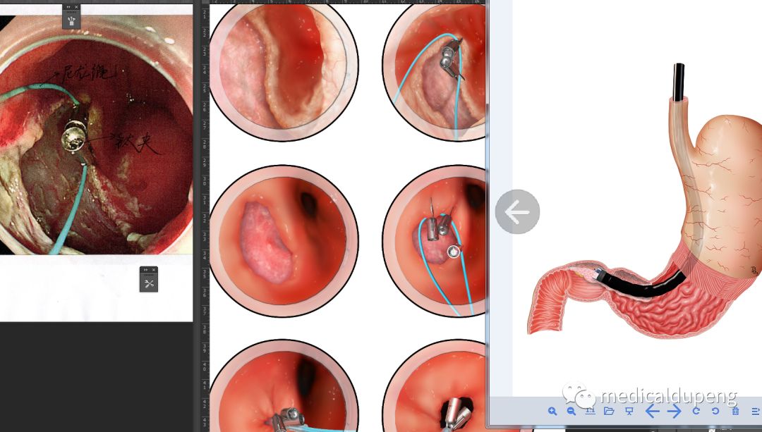 医学插画插图,医学插画sci