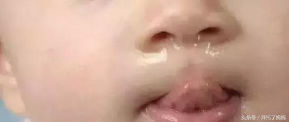 清鼻涕浓稠,清鼻涕小妙招婴儿