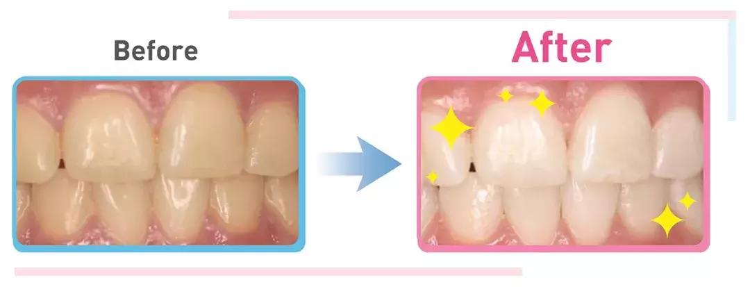 囧！天仙脸配上大黄牙，这是什么操作？！