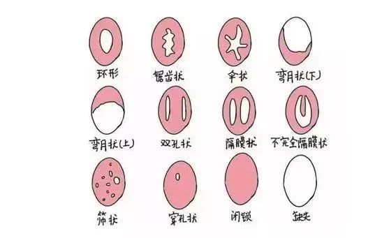 梁晓燕课堂：没来大姨妈，我可能是个假女人？