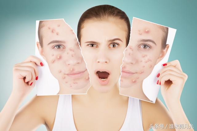 眉中间长痘痘是什么原因怎么调理,眉两边长痘痘是什么原因引起的