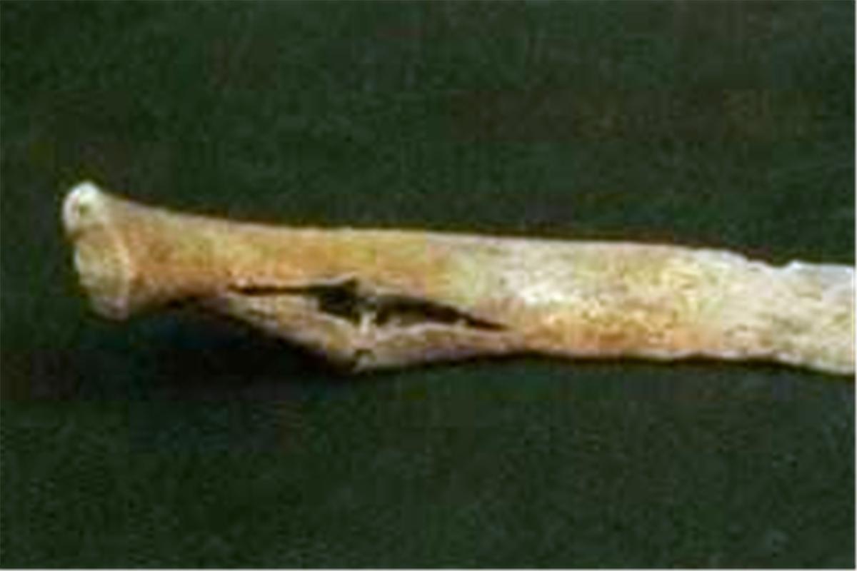 零口姑娘遇害事件,零口姑娘如何死的