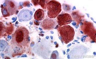 10岁小孩打狂犬疫苗有什么副作用,狂犬疫苗有副作用怎么解决