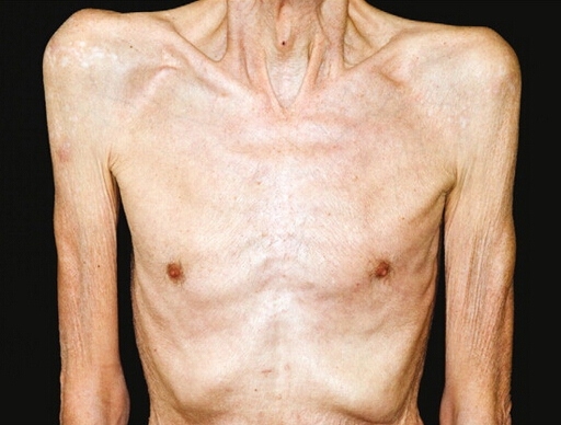 怎么吃都长不胖该如何解决,怎么吃都胖不起来是什么原因