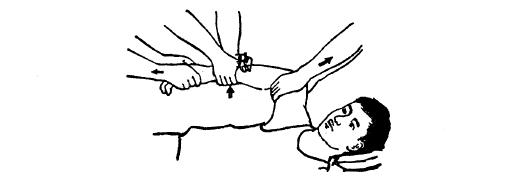 中医骨折治疗原则,中医骨伤整复术