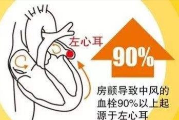 轻微脑梗塞需要注意什么事项,出现轻微的脑梗塞怎么办