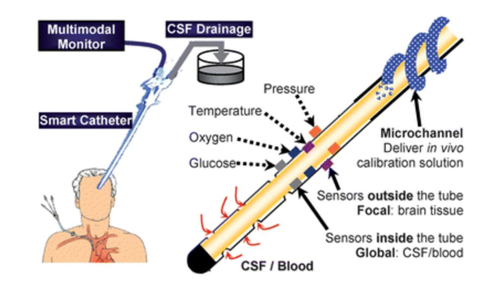 体内植入定位芯片,体内植入微型芯片