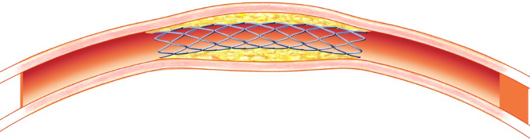 脚发麻发凉发痛应该挂哪个科,脚痛膝盖疼旁边筋痛