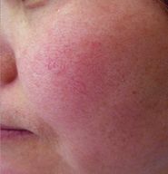 有了这瓶“液体黄金“,今年秋冬注定与干燥、长痘无缘了!