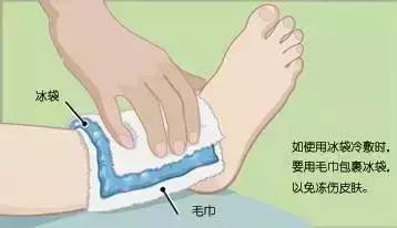 踝关节崴脚后期怎么解决,踝关节扭伤外翻崴脚