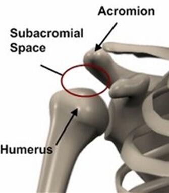 骨头响，骨头疼，80%认为是缺钙，医生说“大错特错”