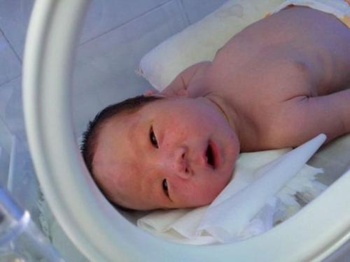 宝宝一出生头上就长这种瘤怎么办!如何识别良性OR恶性?