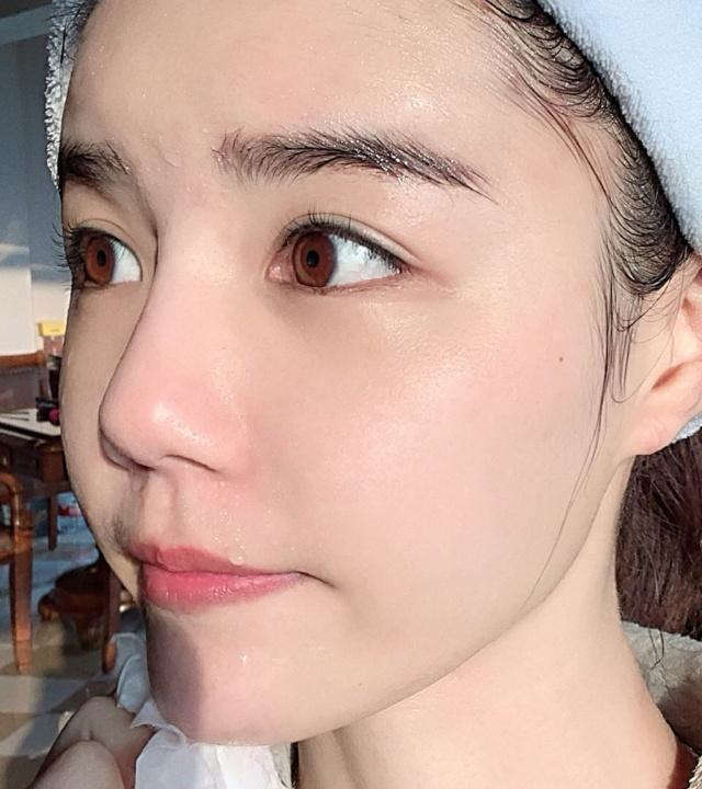 男士脸部干燥缺水补水,脸部缺水突然大量补水脸起红块