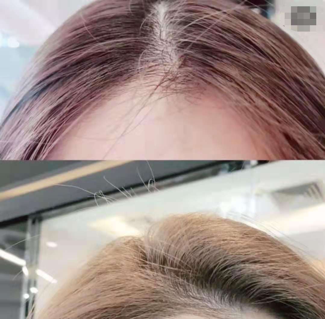 头发少细软塌贴头皮烫发,头发稀少细软适合什么发型烫发